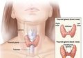 Mengenal Hipertiroid dan Hipotiroid, Gangguan Kelenjar Tiroid pada Anak
