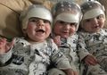 Bayi Kembar Tiga Jalani Operasi Pertama di Tengkorak