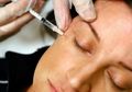 Benarkah Botox Berpeluang Lemahkan Kanker?
