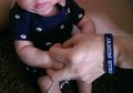 Jax, Bayi Anencephaly Rayakan Ulang Tahun Pertamanya