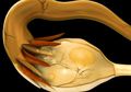 7 Fakta Penting "Polycystic Ovary Syndrome"