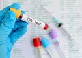 5 Pasien "Sembuh" dari HIV dalam Uji Coba Vaksin