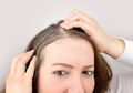 Peneliti: Stres Benar-benar Bisa Membuat Rambut Kita Beruban