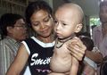 Pernikahan Dini Picu Lahirnya Anak Bertubuh Kerdil, Benarkah?