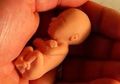 Mayat Bayi Prematur Dibuang di Bak Sampah