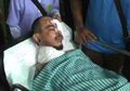 Berry 'Saint Loco' Luka Parah di Wajah Gara-gara Disiram Air Keras