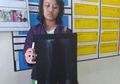 Korban Penembakan Misterius Terhadap Perempuan di Magelang Terus Bertambah