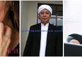 3 Berita Terpopuler: Cara Sembuhkan Kulit Gatal Karena Eksim Hingga Kondisi Rumah Tangga Opick di Tengah Kabar Gugatan Cerai Istrinya