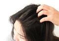 Gata-Gatal Pada Rambut Karena Ketombe? Tak Perlu Bingung, Coba Pakai Ramuan Alami Ini