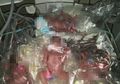 Lahir Prematur dengan Bobot 1 Kilogram, 4 Bayi Kembar di Pangkalpinang Satu per Satu Meninggal