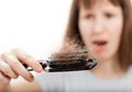 Begini Cara Natural Mengatasi Kerontokan Rambut Akibat Penyakit Hipotiroidisme