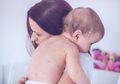 Jika Leher Bayi Terkena Ruam, Lakukan Cara Ini untuk Mengatasinya