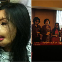Kebangkitan Hidup Lisa 'Face Off' Setelah 14 Tahun Hidup dengan Wajah Penuh Luka Bakar