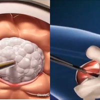 Dari Pengangkatan Tumor Otak Hingga Penggantian Kelamin, 7 Animasi Ini Tunjukan Bagaimana Operasi Medis Berlangsung