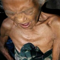 Kisah Lansia Kakak Adik di Mamuju, Badan Kurus Kering Karena Tak Makan Berhari-hari