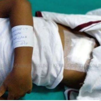 Saat Dokter yang Seharusnya Mengoperasi Hidung Malah Mengoperasi Perut Pasien, Ternyata Ini Penyebabnya