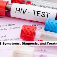 Seorang Pria dalam Video ‘Vina Garut’ Positif HIV, Ini Gejala Seorang Pria Terjangkit HIV, Salah Satunya Terlihat di Mulut dan Hidung