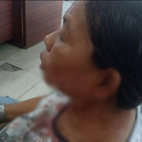 Tengah Buka Warung untuk Jualan, Wanita Ini Tiba-tiba Dipukuli Pria Secara Membabi Buta di Kepala dan Bagian Mata dengan Kayu