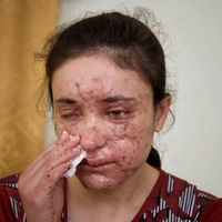 Kejam, Perempuan 10 Tahun Dipaksa Jadi Budak Seks ISIS dan Diperkosa hingga Tewas di Depan Ayah dan Saudarinya