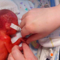 Dulu Lahir Prematur Dengan Otak Terlihat dari Kulitnya, Sekarang Beginilah Penampilan Bayi Ini di Ulang Tahun Pertamanya