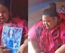 4 Fakta Operasi Bariatrik Titi Wati, Wanita Obesitas 220 Kg yang Sempat Viral