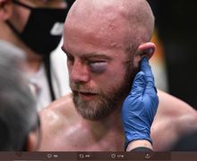 Kalah Mengenaskan, Petarung UFC Ini Alami Cedera Mata Mengerikan