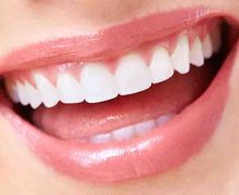 Gigi Putih Tanpa Veneer, Cukup Gunakan Minyak Kelapa