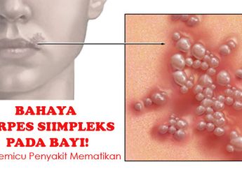 Herpes Simpleks, Tahap Awal Si Kecil Terserang Penyakit Serius!