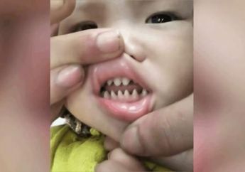 Orangtua Unggah Foto Gigi Anaknya yang Tajam Mirip Gigi Hiu, Eh Warganet Justru Kesal!