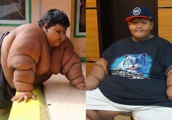 Masih Ingat Bocah Obesitas Aria Permana? Begini Kabarnya Sekarang