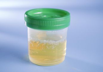 5 Alasan Mengapa Urine Kita Berbusa, Bisa Jadi Tanda Bahaya loh!