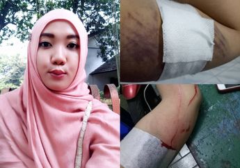 Cabut KB Implan yang Terpasang di Lengan, Seorang Ibu Alami Hal Ini