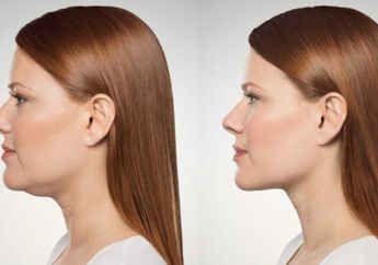 Hanya Dengan Makan bahan alami ini, Double Chin bisa Hilang Seketika! Enggak Perlu Botox!