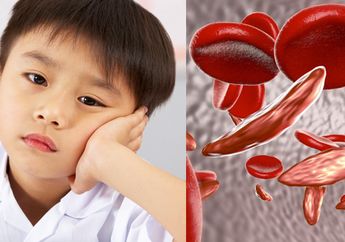 Jangan Abaikan Anemia, Ini Dampaknya Bagi Kesehatan Ibu Hamil dan Anak