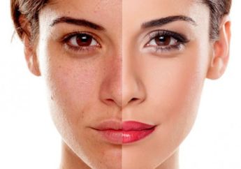 Tanpa Skincare, Kulit Kusam Bisa Diatasi dengan 5 Cara Ini Aja!