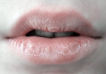 5 Cara Atasi Bibir Kering dan Rusak karena Sering Pakai Lipstik!