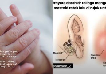 Bayi Alami Pendarahan di Kepala Akibat Terlempar dari Tangan Baby Sitter