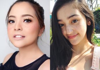 Heboh Tren Riasan Wajah Bintik-bintik, Inilah 7 Fakta Menarik di Balik Freckles