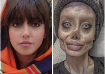 Puluhan Kali Operasi Plastik Agar Mirip Angelina Jolie, Nasib Wanita Ini Berujung Tragis!