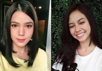 Tanpa Make Up, Deretan Artis Ini Cantik Menawan Dengan Freckles Alami