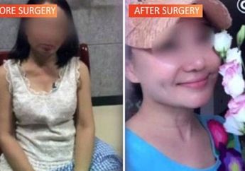 Permak Total Penampilannya Sampai Dikira Masih ABG, Alasan Nenek Ini Jalani Operasi Plastik Hingga Rogoh Kocek Dalam-dalam Bikin Orang Tercengang!