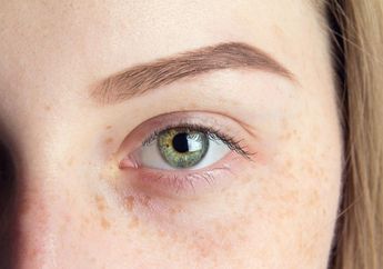 Intip yuk Cara Alami Hilangkan Bintik Matahari, Ternyata Gampang Banget!