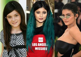 Transformasi Wajah Kylie Jenner dari Tahun ke Tahun. Banyak Berubah?