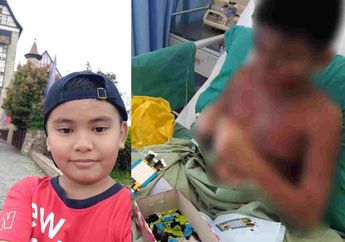 Akibat Obat, Tubuh Bocah Mendadak Melepuh dan Penglihatan Kabur