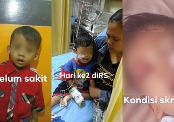 Kecanduan Main Ponsel, Bocah Malang Ini Idap Kanker Darah Stadium 4