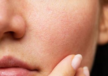 5 Cara Alami untuk Mengecilkan Pori-Pori Besar. Bikin Wajah Jadi Flawless!