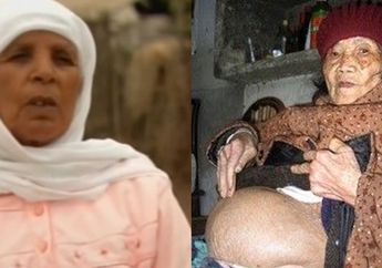 Wanita ini Hamil Selama 46 Tahun, Begini Rupa Sang Bayi Ketika Lahir