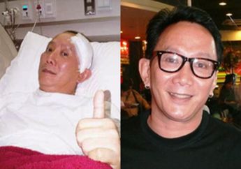 Robby Tumewu Meninggal Setelah Sakit Hingga Tenggorokannya Berlubang, Ternyata Makanan Ini Jadi Pemicunya