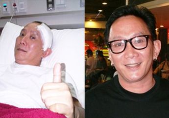 Robby Tumewu Stroke Hingga Lubangi Tenggorokannya, Hindari 3 Makanan Berikut