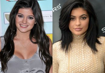 6 Seleb Hollywood Ini Dikabarkan Telah Melakukan Operasi Plastik